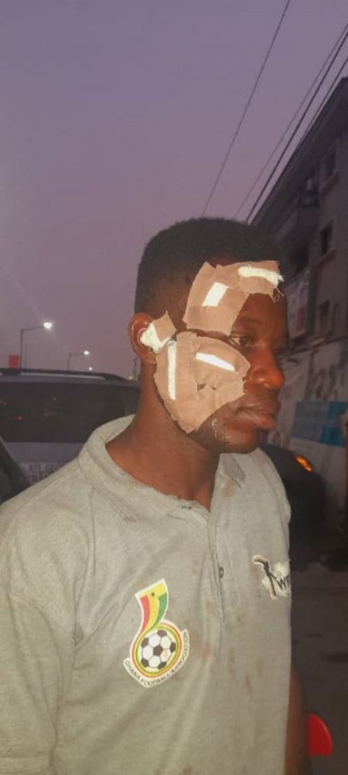 TFG President  expresses outrage on the attack on the Ghanaian Wheelchair Tennis Team